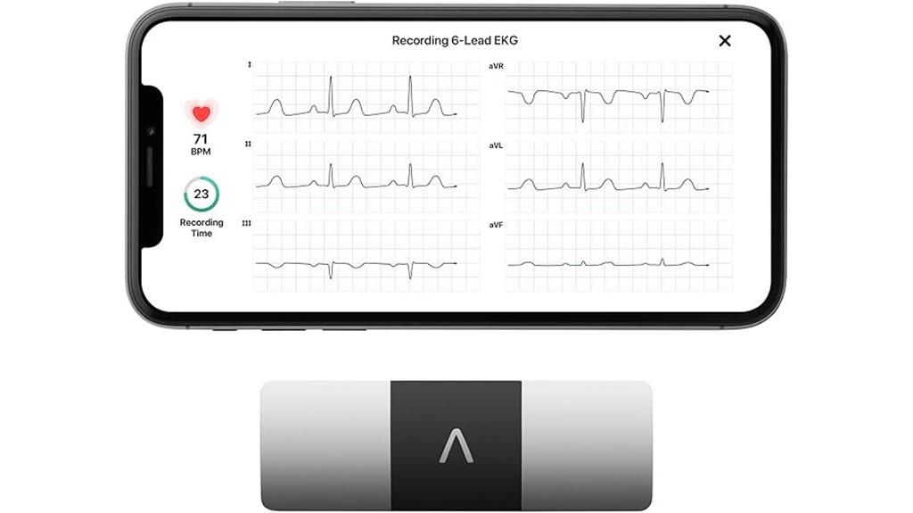 six lead ekg monitor